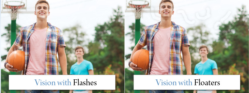 Floaters &amp; Flashes - Accent on Vision Albuquerque